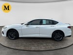 2025 Acura TLX A-Spec Package SH-AWD