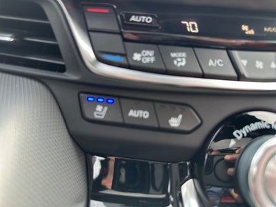 2025 Acura TLX A-Spec Package SH-AWD