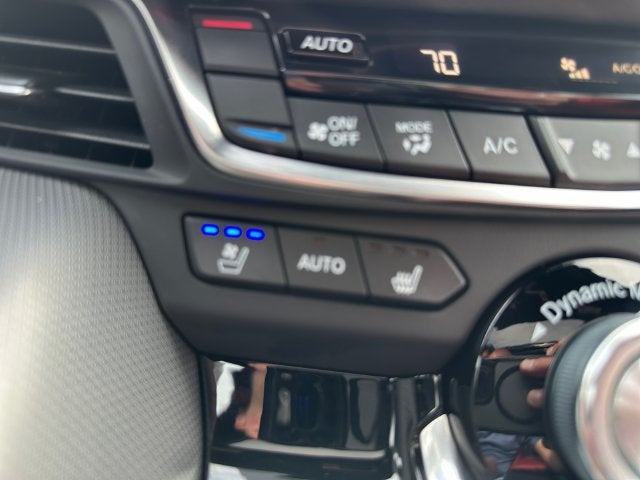 2025 Acura TLX A-Spec Package SH-AWD